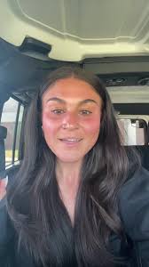 Overcoming Old Patterns After Weight Loss