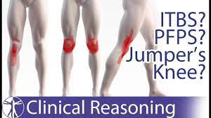 Atraumatic Knee Pain Differential Diagnosis Itbs Pfps Jumper S Knee Youtube