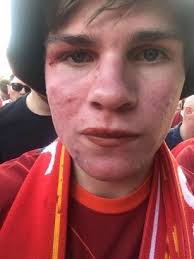 I really thought I was going to die': The children tear-gassed and  terrorised in Paris