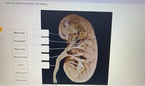 Four or five minor calyces merge to form a major calyx. Solved Label The Internal Anatomy Of The Kidney Minor Ca Chegg Com