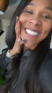 Porcelain Veneers and Teeth Contouring Experience in Atlanta