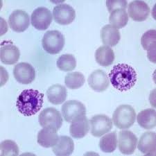 Malaria is caused by plasmodium parasites. Protein Map Could Aid Development Of Malaria Vaccine Mdedge Hematology And Oncology