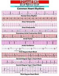 Maybe you would like to learn more about one of these? Ecg Made Easy Pdf ØªØ­Ù…ÙŠÙ„