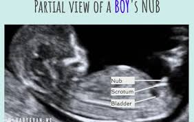 Where can i get a 3d ultrasound in washington state? How Nub Theory Can Predict Baby Gender From 12 Weeks Scan