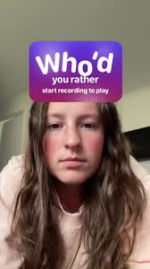 Edward Play Kisses Dad