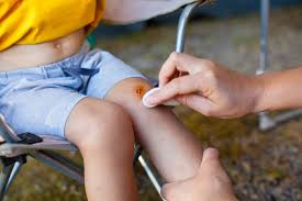 Eine blutung ist kein feind, sondern eine sinnvolle reaktion des körpers. Naturliche Hausmittel Fur Kinder Bei Schurfwunden Insektenstichen Oder Prellungen