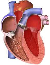 Image result for Restrictive Cardiomyopathy