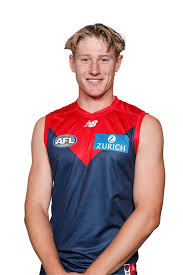 images?q=tbn:ANd9GcRf4AaeFkK1fvcW56dvt-P