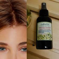 This Works Great For My Major Scabs And Flakes I Get On My Dry Scalp I Use Product To Solve A Constant Problem With Dry Dry Itchy Scalp Dry Scalp