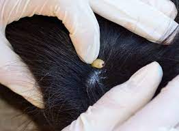 Check for legs (see #1). My Dog Has A Tick Hillcrest Animal Hospital