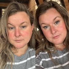 What do users think of this skincare product?