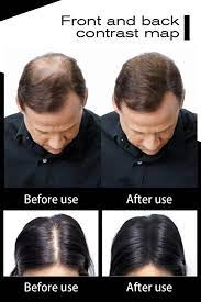 Hair Building Fibers Keratin Thickening Spray Hair Building Fibers Loss Hair Thickening Hair Thickening Fibers Instant Hair Thickening