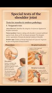Image result for Yergason Test