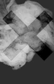 La un dat, el zareste in compartiment o fata tanara, care statea pe fotoliul din fata. Ion Rezumat Pe Capitole Wattpad Move Flex Gel In Romania