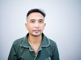 Cerita Piyu Padi Reborn Jalani Transplantasi Rambut