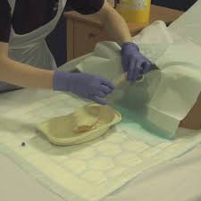 Image result for Urethral Catheterization