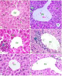 Image result for Gnidia involucrata