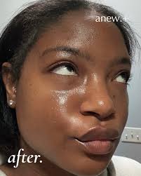 Attorney recommendations for Elmhurst beneficiary deeds