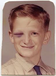 He S Smiling One Eye Is Swollen Shut And You Can Still See The Mischief In His Eye I Love This Kid This Picture Makes Me Funny School Pictures Photo Face