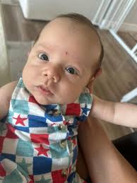 Patient: I'm worried about this birthmark. Doctor: Birthmark, you say? How  long have you had it?