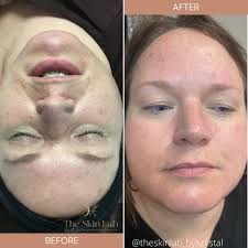 𝐾𝑟𝑦𝑠𝑡𝑎𝑙 𝑂𝑟𝑡𝑖𝑧 L.E🧪🤍 (@theskinlab_bykrystal) • Instagram  photos and videos