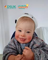 For this week's #PADSTuesdayTotspot we hear from mum Becky about little  Freya 💛 Freya loved wearing her hearing headband for the first time. She  constantly surprises us by how she takes everything