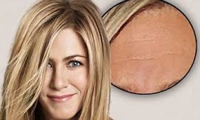 Get your hair cut with front fringes. Jennifer Aniston S Forehead Lines Magically Disappear With The Aid Of The Airbrush In New Haircare Campaign Daily Mail Online