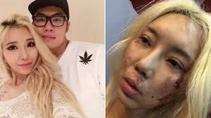 If for any reason you can not use plastic surgery, but requires a clear improvement, then you are natural methods. Top Malaysian Dj Posts Horrific Facebook Photos Accusing Boyfriend Of Abuse