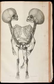The Sick Rose Disease And The Art Of Medical Illustration Own A Piece Of Morbid Medical History Medical Illustration Skeleton Illustration Art
