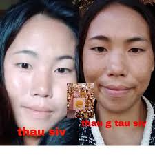 👉👉Kni cream kni ກັນແດດ 💕 siv zoo pob zoo hiav heev li so🥰🥰🥰 Zoo kab  lau kab txoom👈👈👈 💥💥ເຄນິ່ຄີມປົວຝ້າປົວສິວ  ນີ້ແມ່ນລິວິດລູກຄ້າຜູ້ໄຊ້ຈີງ💥💥💥💥 #ສົມໃຈຖາມໄດ້02054592866 ...