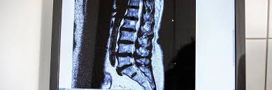 Operative Leistungen Bandscheiben Operation Hws Lws Uvm