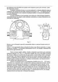 Acea mai frecventa defectiune a instalatiei de racire a motorului este slabirea sau ruperea curelei care antreneaza ventilatorul si pompa de apa. Atestat Intretinerea Defectiunile Si Repararea Instalatiei De Racire A Autovehiculelor Atestat MecanicÄ