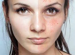 Karbonatin Cilde 5 Mukemmel Faydasi Sosyolife Net Ev Yapimi Cilt Bakimi Cilt Urunleri Dogal Guzellik Ipuclari