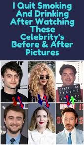 Celebrity S Before After Pictures 10 Years Celebrities Fun Facts Celebrity Gossip