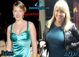 She was five years old when the . Jodie Sweetin Archives Plastic Surgery Facts