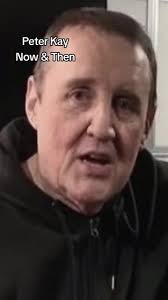 Peter Kay Weight Loss Transformation Revealed!