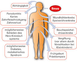 Snus wirkung, snus sport, snus kaufen, snus droge, snus fußball, snus tabak, snus schäden, snus shop. Https Www Dkfz De De Tabakkontrolle Download Deutsche Konferenzen Fuer Tabakkontrolle 8 Deutsche Konferenz Fuer Tabakkontrolle Katrin Schaller 2010 Pdf