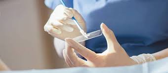 Image result for Pap Smear