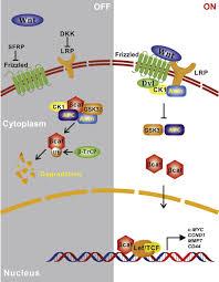 As such, it is difficult to talk about cancer without understanding the specific type of cancer someone has. Breast Cancer Development And Progression Risk Factors Cancer Stem Cells Signaling Pathways Genomics And Molecular Pathogenesis Sciencedirect
