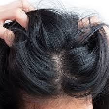 It is a common problem that causes frequent scratching and discomfort. 6 Simple Effective Home Remedies For Itchy Scalp Ahs India