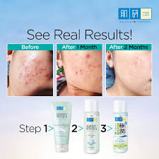 The alpha line has been reformulated in 2013 but the website still shows the old ingredients, the gokujyun line still shows pictures of the old packaging, the new shirojyun premium products aren't listed on the website, etc. Twtkecantikan On Twitter Antara Contoh Chemical Exfoliating Toner 1 Benton Aloe Bha Skin Toner Bha Aloe Vera Extract 2 Hada Labo Tamago Mild Peeling Lotion Pha 3 Corsx