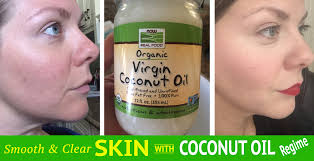 coconut oil regime for beautiful clear skin