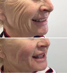 We had quite a response to our latest post