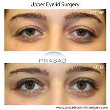 Prasad Cosmetic Surgery