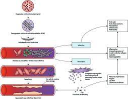 Management Of Sickle Cell Anemia Abdominal Key