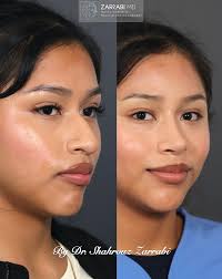 Dr. Shahrouz Zarrabi, MD (@dr.shahrouz.zarrabi) • Instagram photos and  videos