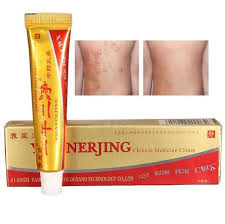 Yiganerjing Vitiligo Vitiligo Treatment Chinese Herbal Medicine