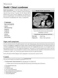 Budd Chiari Syndrome Angiology Liver