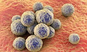 In hospitalized patients, it can cause sepsis, surgical site infections, and pneumonia. Treatment For Mrsa No Longer More Costly Than For Susceptible Staph Aureus Infections