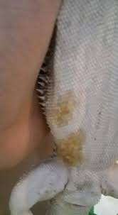 Can humans get diseases from lizards? Bearded Dragon Yellow Fungus Learn Before It S Too Late
